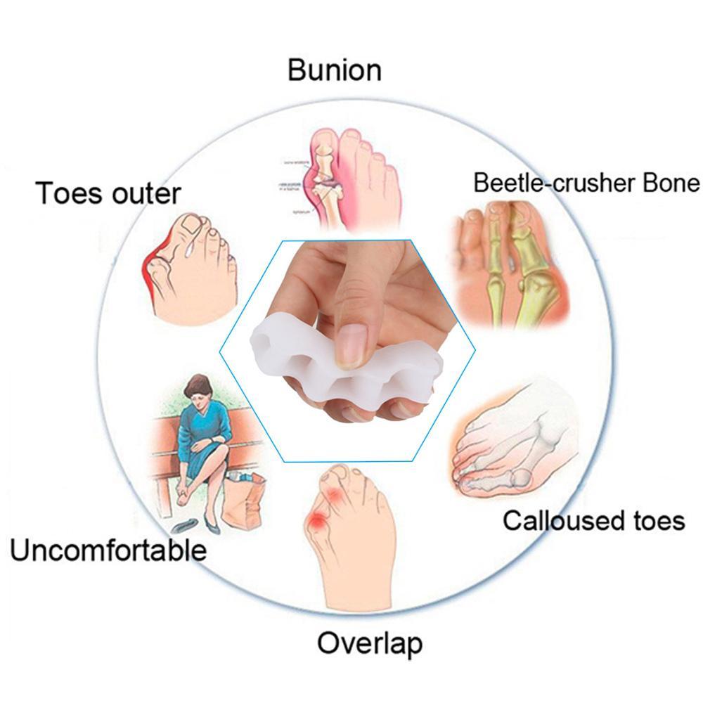 Orthopedic Bunion Corrector (1 PAIR)