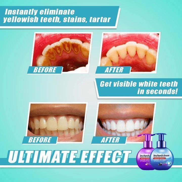 INSTANT STAIN REMOVAL WHITENING TOOTHPASTE