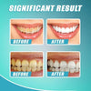 Load image into Gallery viewer, INSTANT STAIN REMOVAL WHITENING TOOTHPASTE